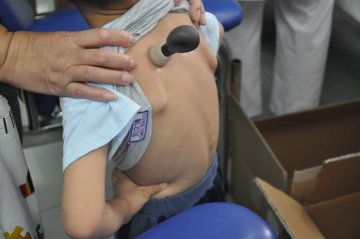 儿童敷三伏贴