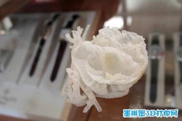 3D打印人体心脏助力医生制定手术方案