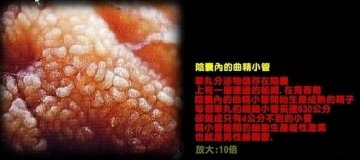 阴囊