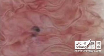 神奇的生命：实拍女性排卵真实过程