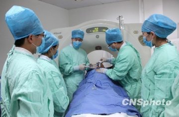 中国每年射频消融手术治疗肝癌近7000例