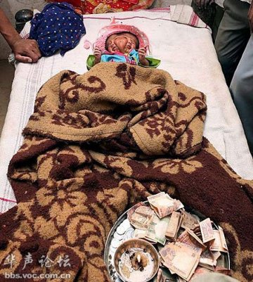 印度双面女婴死亡