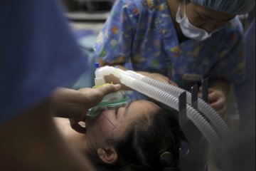 韩国摄影师记录5位模特血腥整容蜕变全程