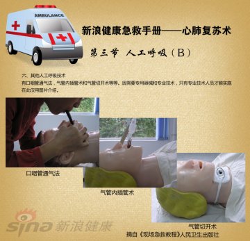 心肺复苏术10-人工呼吸(B)其他人工呼吸技术
