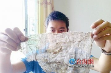 女子产子后体内遗留纱布 医院称系操作失误所致