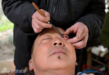 1.师傅在给顾客洗眼，顾客躺着一动不动