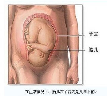 医学实录：女性剖腹产手术全过程