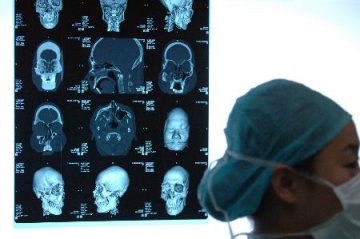 中国首位换脸人第二次手术顺利结束