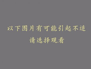 韩国女子整容的术后生活纪实
