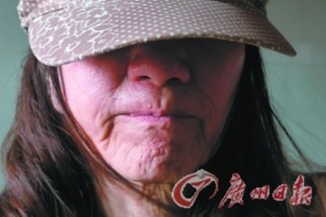 21岁少女长60岁脸 母女上街被当