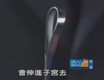 实拍堕胎手术全过程 呼吁珍惜生命