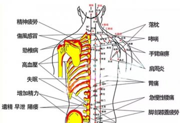 军医提醒：拔火罐后的罐印反映什么问题