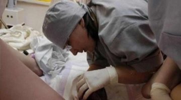 实拍孕妇顺产惊心全过程