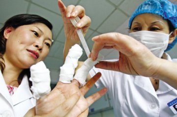 医生为挽救窒息产妇性命五指被咬烂
