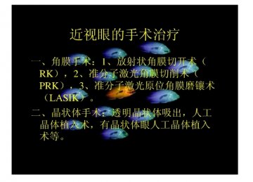 近视眼手术分类