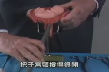实拍：美国堕胎手术全过程