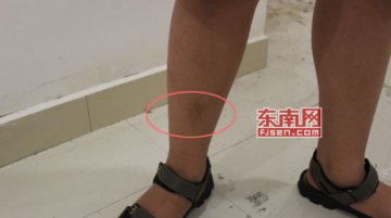 消费者喷云南白药长黑毛频现 厂家称功效明确