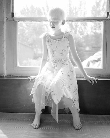 别冷落“罕见病患者”