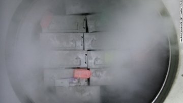 干细胞培育迷你大脑