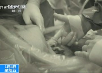 奇闻：婴儿出生时紧握医生手指