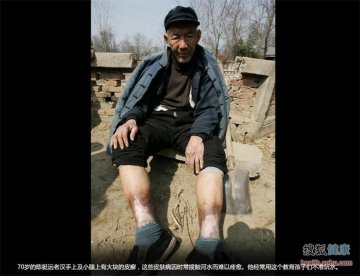 中国“癌症村”地图