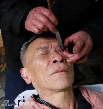 5.师傅在给顾客洗眼，顾客躺着一动不动