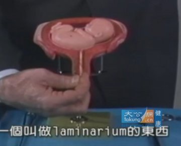 实拍堕胎手术全过程 呼吁珍惜生命
