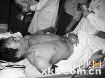 男子当街剖腹肠子外流 疑患被迫害妄想症