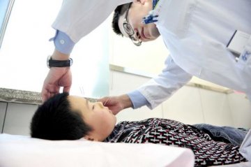 寒假治近视试试针灸