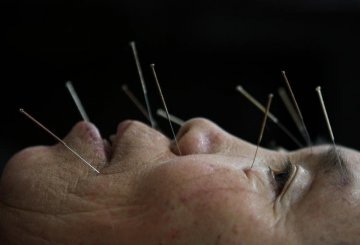 让世界认识中医