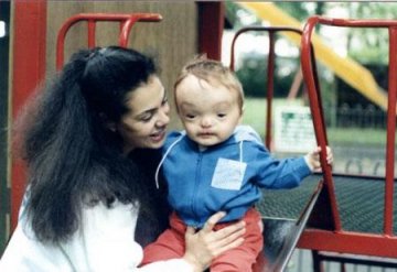 英国面部畸形男子36次手术造出新脸