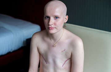 摄影师镜头记录乳腺癌患者重生影像