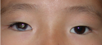 “红眼”与“白瞳”