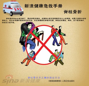 脊柱骨折