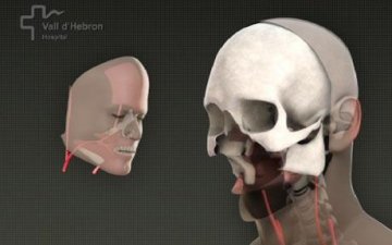 西班牙医生完成世界首例完整面部移植手术