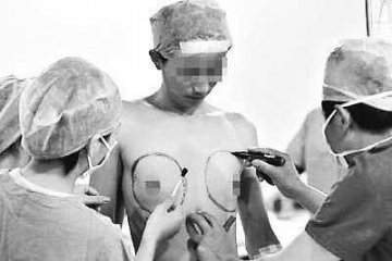 揭开变性手术神秘面纱 实拍男人变女人震撼全程