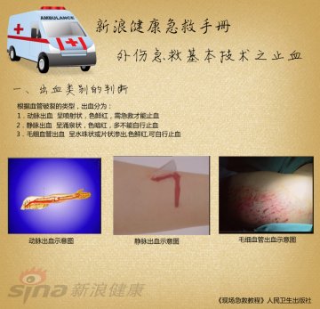 出血类别的判断