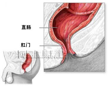 痔疮治疗术