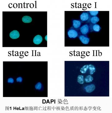 细胞凋亡的检测