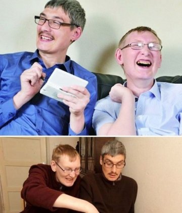 玩玩具看动画英中年兄弟罕见“返老还童”病