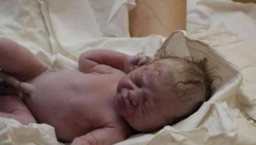 实拍孕妇顺产惊心全过程