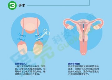 图解：各种靠谱的避孕方法