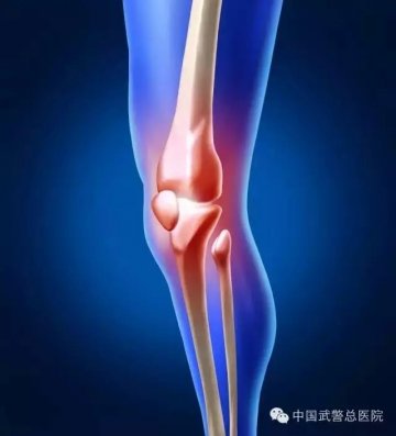 军医支招：健康运动助力膝关节康复