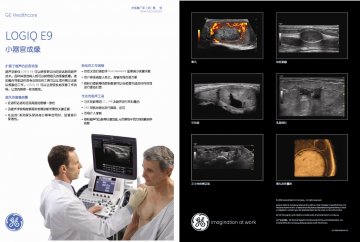 超声诊断仪 Diagnostic Ultrasound Scanner LOGIQ E9--官方高清创意广告(沪医械广审