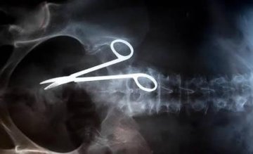瞠目结舌X光片：女人下体都能放点儿啥