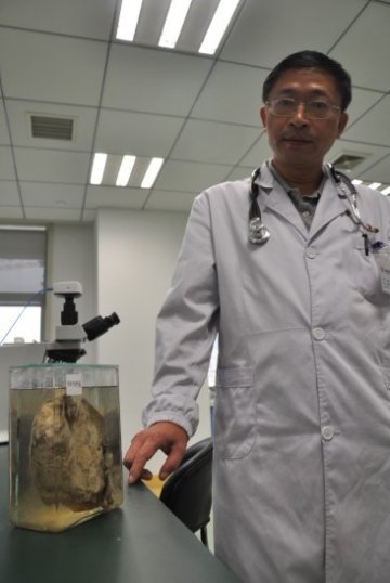 专家提醒：七成肺癌因香烟所致，老烟民应每年定期体检