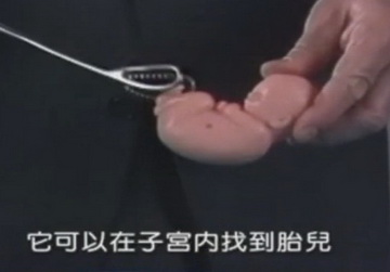 实拍少女人流全过程