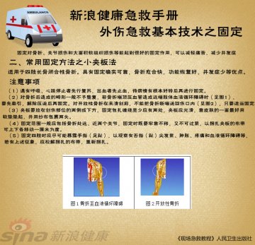 小夹板法注意事项