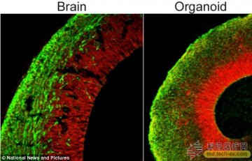 科学家通过诱导多能干细胞培育出大脑模型