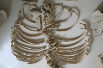 探访“人骨仓库”